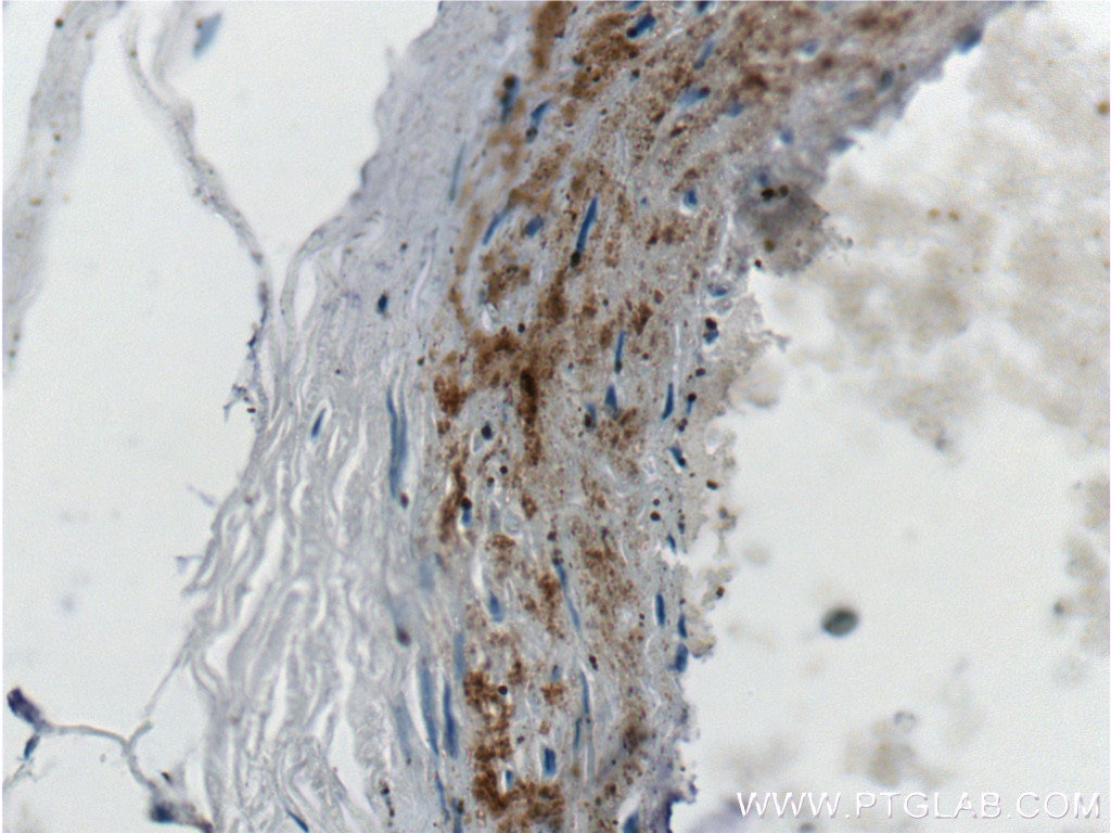 Immunohistochemistry (IHC) staining of human heart tissue using MGP Monoclonal antibody (60055-1-Ig)