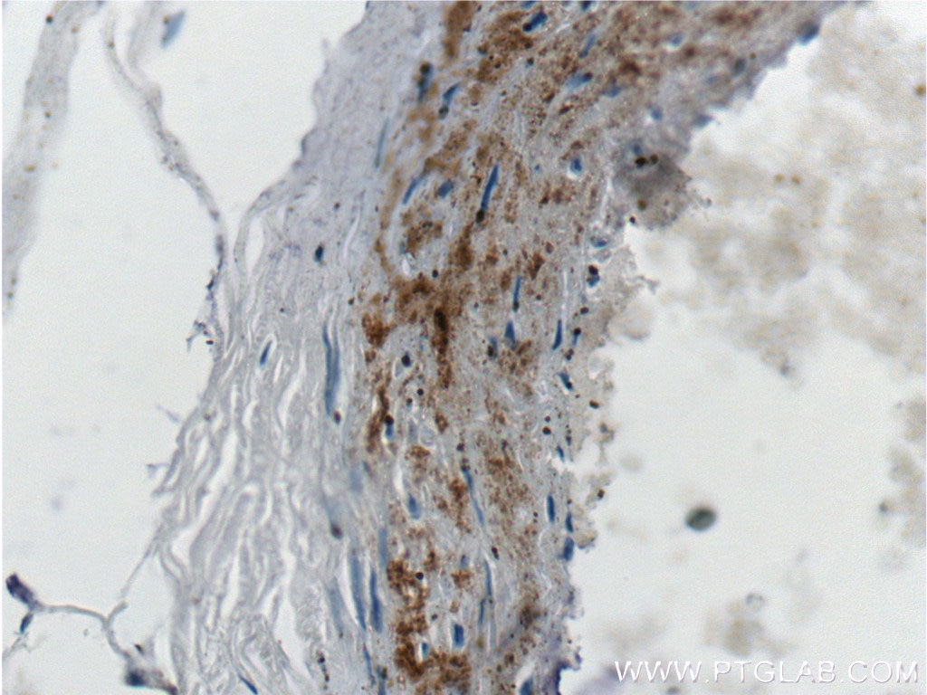 IHC staining of human heart using 60055-1-Ig