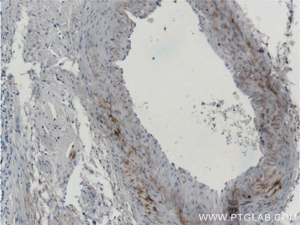 Immunohistochemistry (IHC) staining of human kidney tissue using MGP Monoclonal antibody (60055-1-Ig)