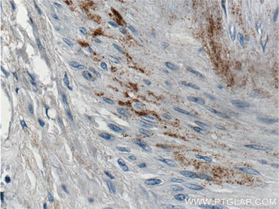 Immunohistochemistry (IHC) staining of human kidney tissue using MGP Monoclonal antibody (60055-1-Ig)