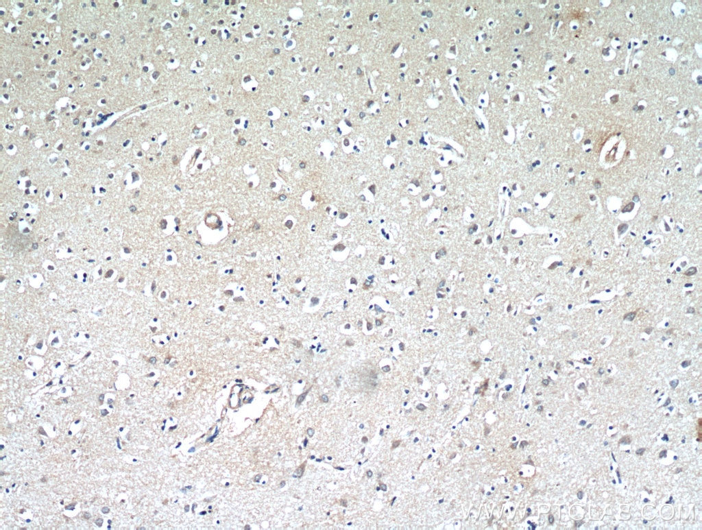 Immunohistochemistry (IHC) staining of human brain tissue using MGP Monoclonal antibody (60055-1-Ig)