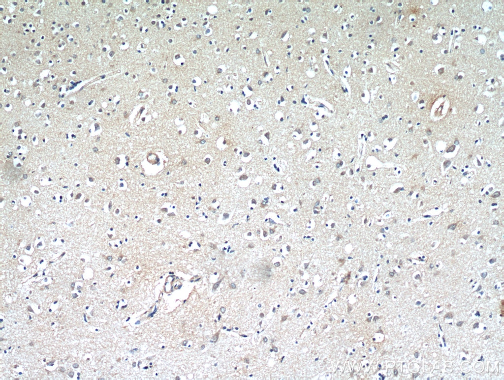 IHC staining of human brain using 60055-1-Ig