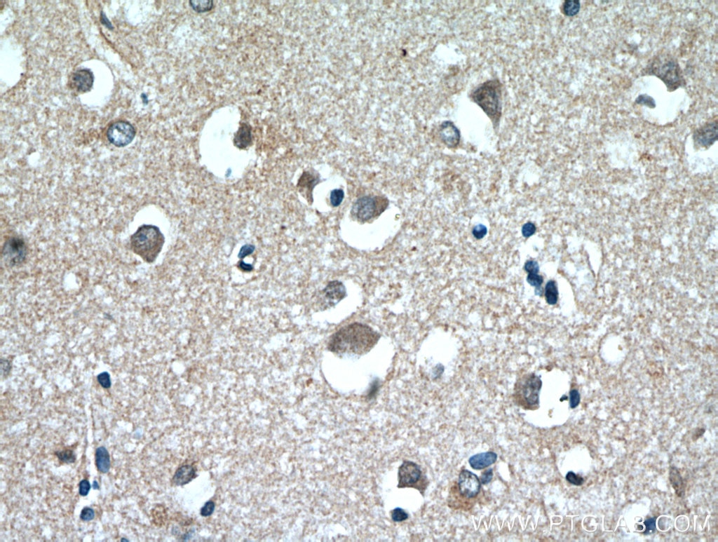 Immunohistochemistry (IHC) staining of human brain tissue using MGP Monoclonal antibody (60055-1-Ig)