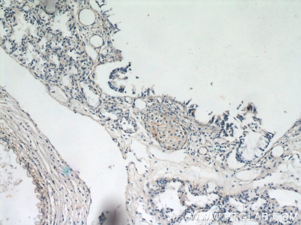 Immunohistochemistry (IHC) staining of human lung tissue using MGP Monoclonal antibody (60055-1-Ig)