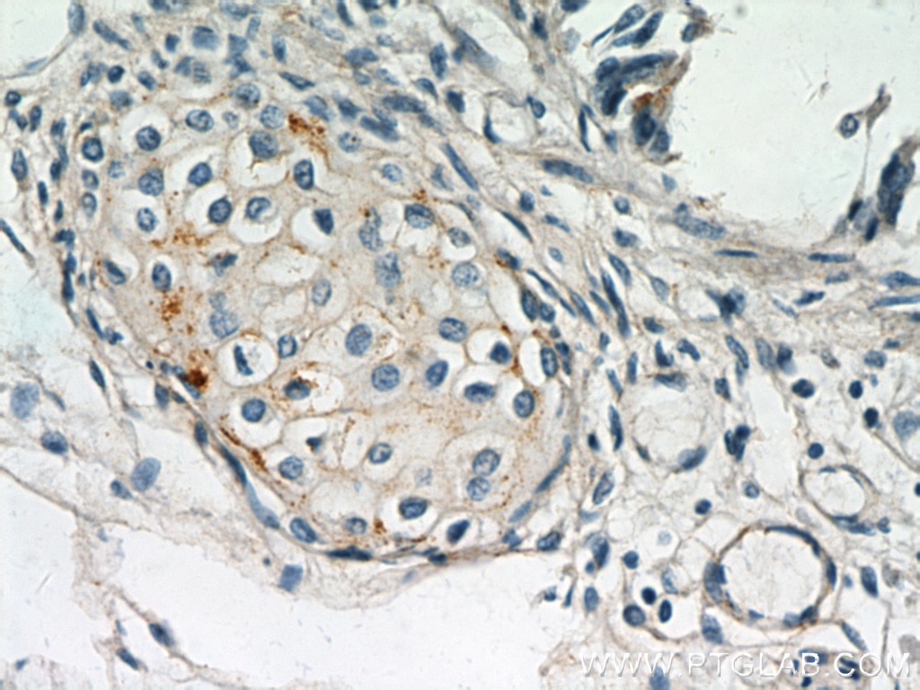 Immunohistochemistry (IHC) staining of human lung tissue using MGP Monoclonal antibody (60055-1-Ig)