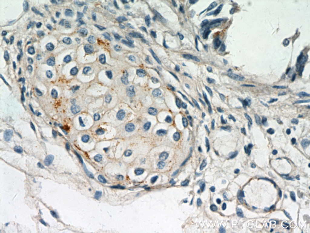 IHC staining of human lung using 60055-1-Ig