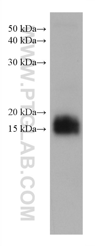 Western Blot (WB) analysis of human saliva using MGP Monoclonal antibody (60055-1-Ig)