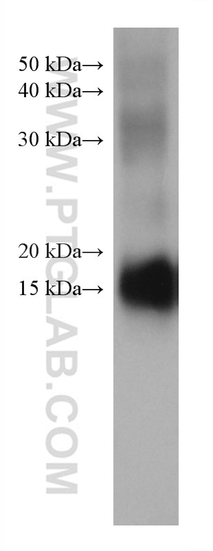 Western Blot (WB) analysis of human liver cancer tissue using MGP Monoclonal antibody (60055-1-Ig)