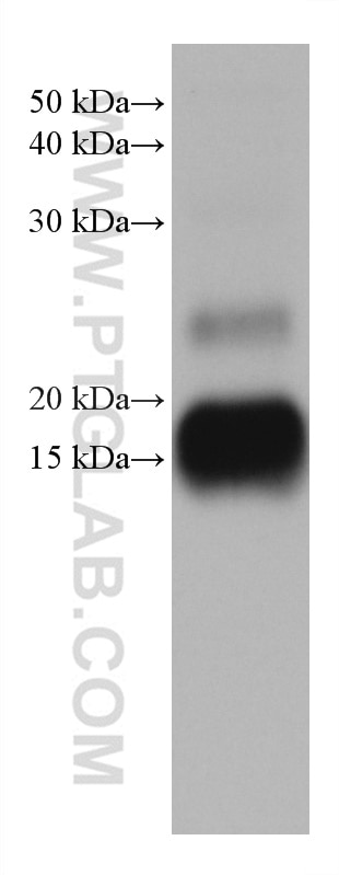 Western Blot (WB) analysis of human placenta tissue using MGP Monoclonal antibody (60055-1-Ig)