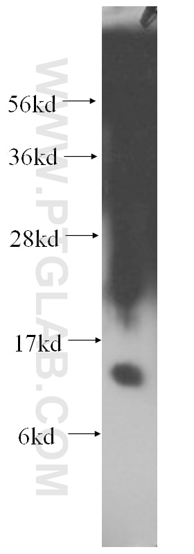 Western Blot (WB) analysis of human kidney tissue using MGP Monoclonal antibody (60055-1-Ig)