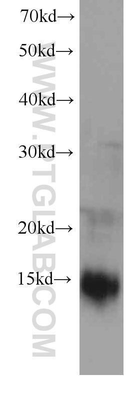 Western Blot (WB) analysis of human brain tissue using MGP Monoclonal antibody (60055-1-Ig)