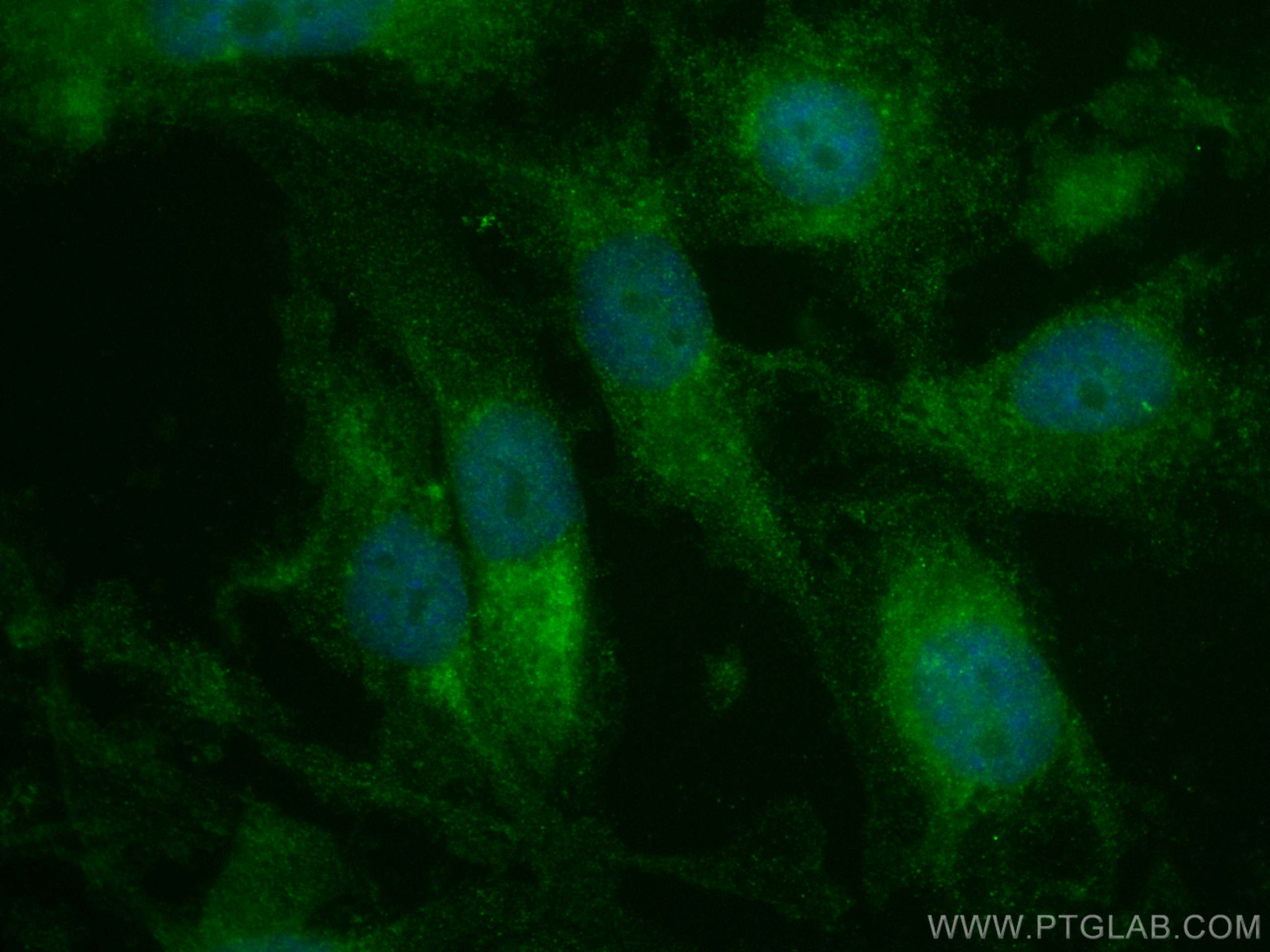 Immunofluorescence (IF) / fluorescent staining of MDA-MB-231 cells using CoraLite® Plus 488-conjugated MGP Monoclonal antib (CL488-60055)