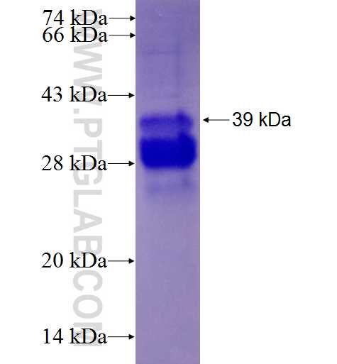 MGP fusion protein Ag1091 SDS-PAGE
