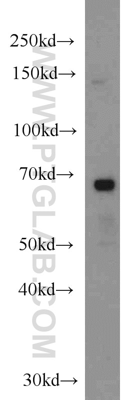 Western Blot (WB) analysis of mouse brain tissue using RNF156 Polyclonal antibody (11285-1-AP)