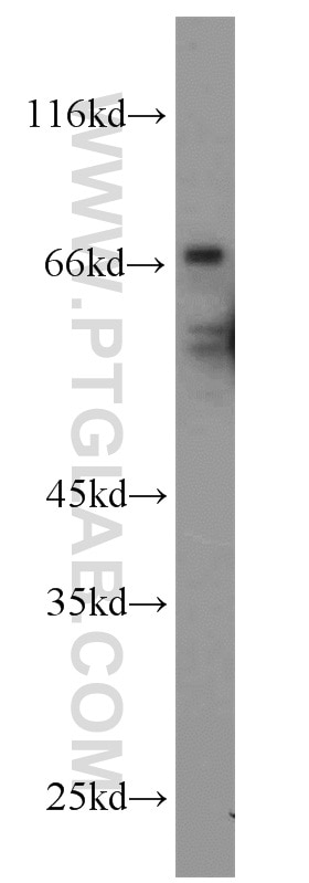 Western Blot (WB) analysis of HeLa cells using RNF156 Polyclonal antibody (11285-1-AP)