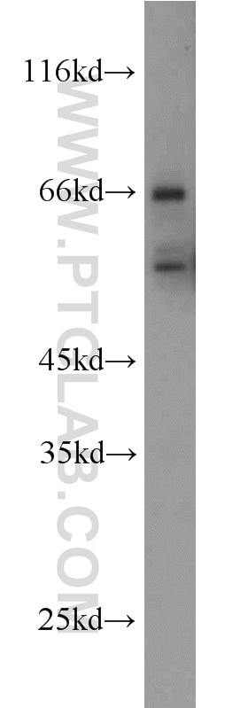 Western Blot (WB) analysis of HepG2 cells using RNF156 Polyclonal antibody (11285-1-AP)