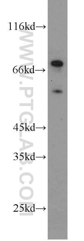 Western Blot (WB) analysis of HEK-293 cells using RNF156 Polyclonal antibody (11285-1-AP)