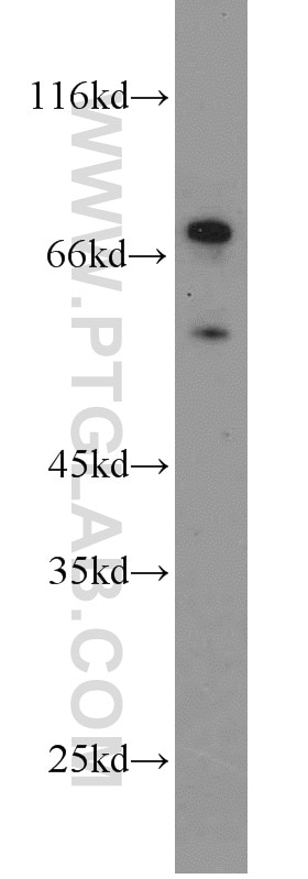 WB analysis of HEK-293 using 11285-1-AP