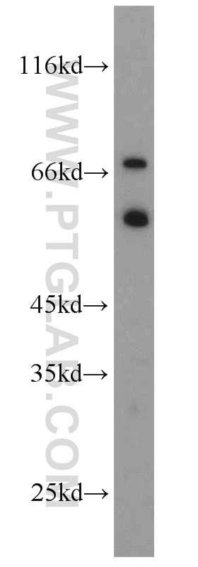 Western Blot (WB) analysis of mouse brain tissue using RNF156 Polyclonal antibody (11285-1-AP)