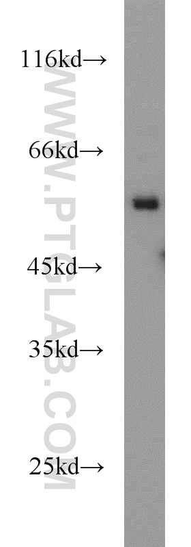 Western Blot (WB) analysis of mouse brain tissue using RNF156 Polyclonal antibody (11285-1-AP)