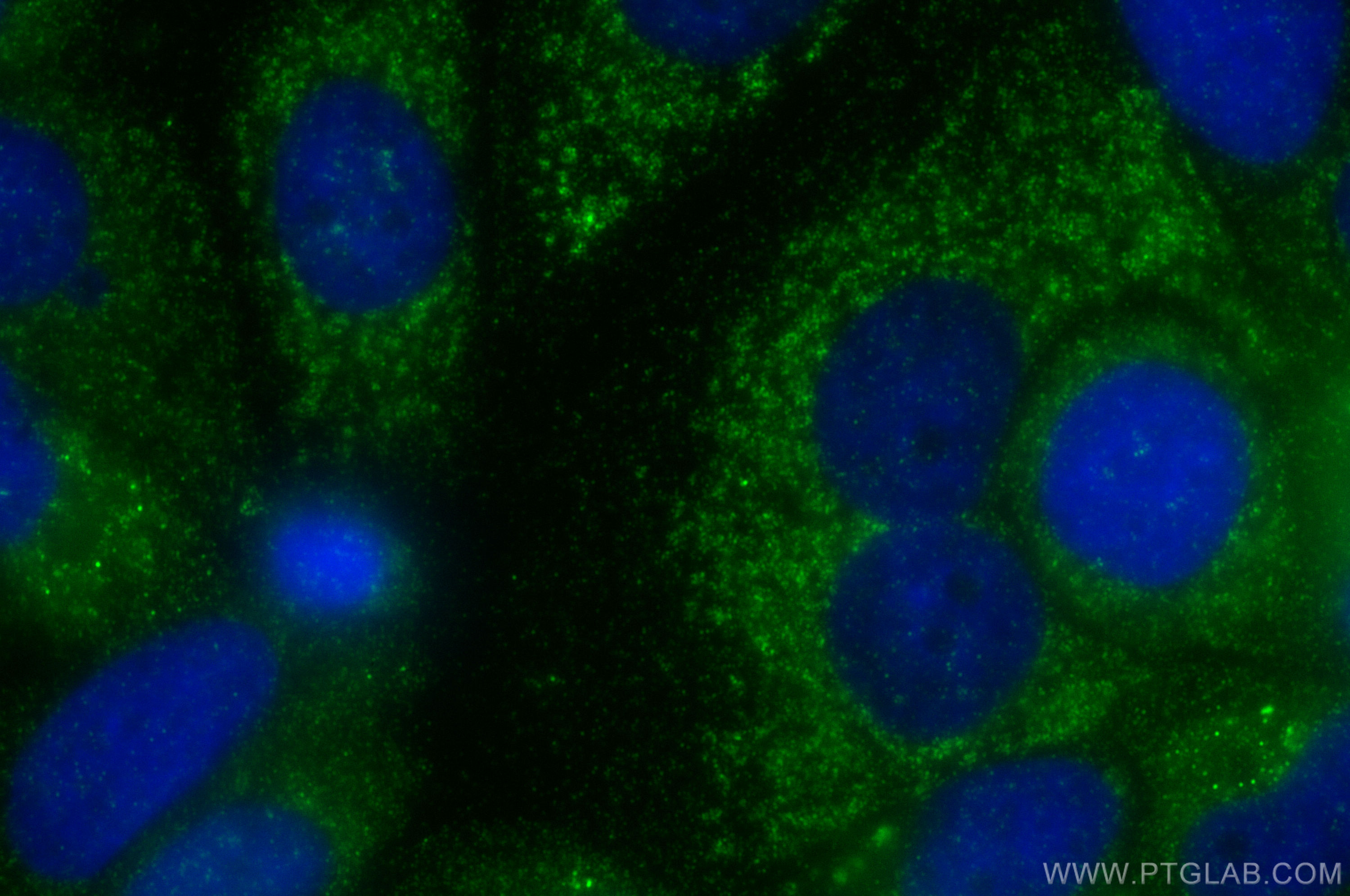Immunofluorescence (IF) / fluorescent staining of MCF-7 cells using MGST1 Polyclonal antibody (15906-1-AP)