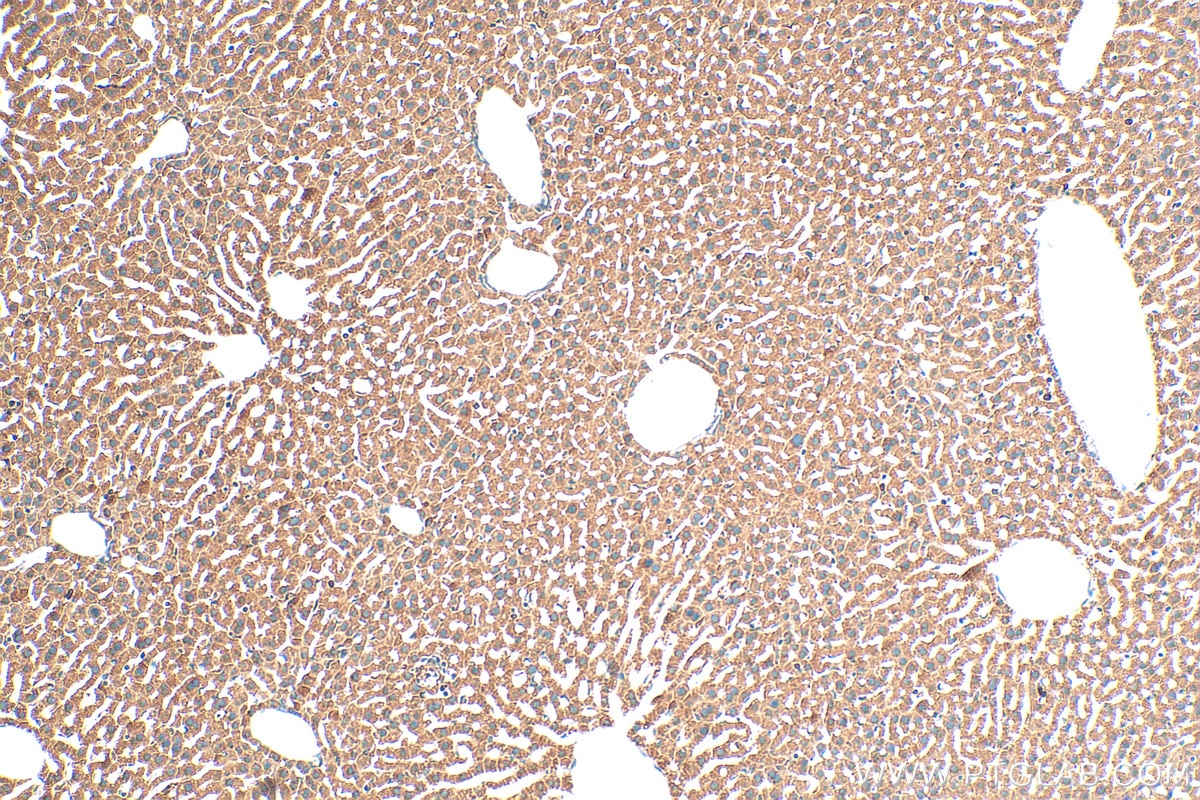 Immunohistochemistry (IHC) staining of mouse liver tissue using MGST1 Polyclonal antibody (15906-1-AP)