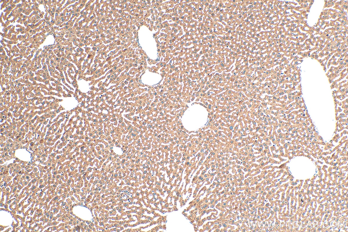 IHC staining of mouse liver using 15906-1-AP