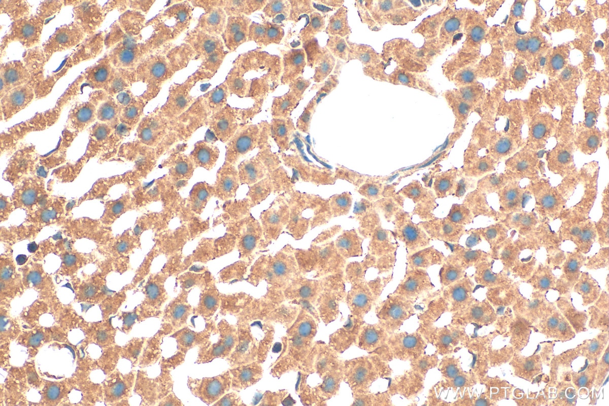 IHC staining of mouse liver using 15906-1-AP