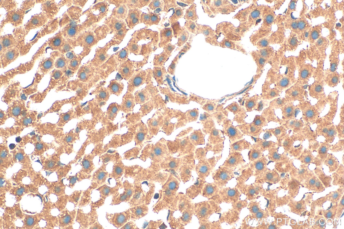 Immunohistochemistry (IHC) staining of mouse liver tissue using MGST1 Polyclonal antibody (15906-1-AP)