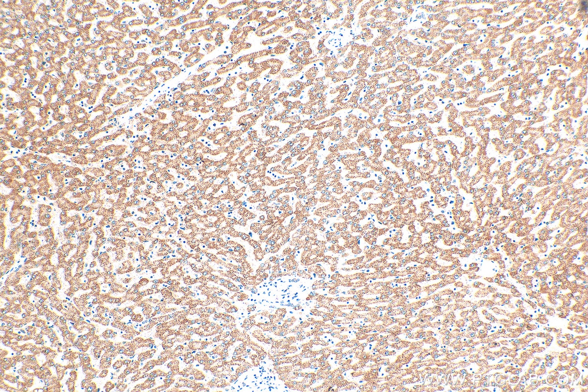Immunohistochemistry (IHC) staining of human liver tissue using MGST1 Polyclonal antibody (15906-1-AP)