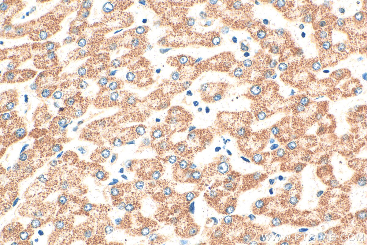 IHC staining of human liver using 15906-1-AP