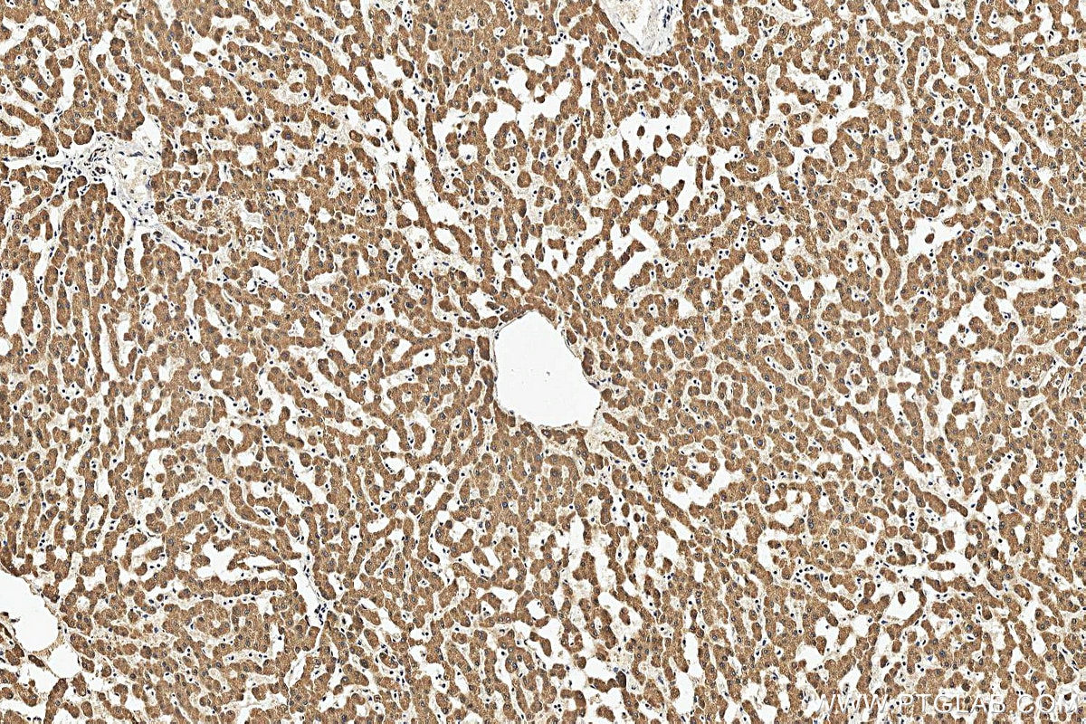 IHC staining of human liver using 25451-1-AP Immunohistochemistry (IHC) staining of human liver tissue using MGST2 Polyclonal antibody (25451-1-AP)