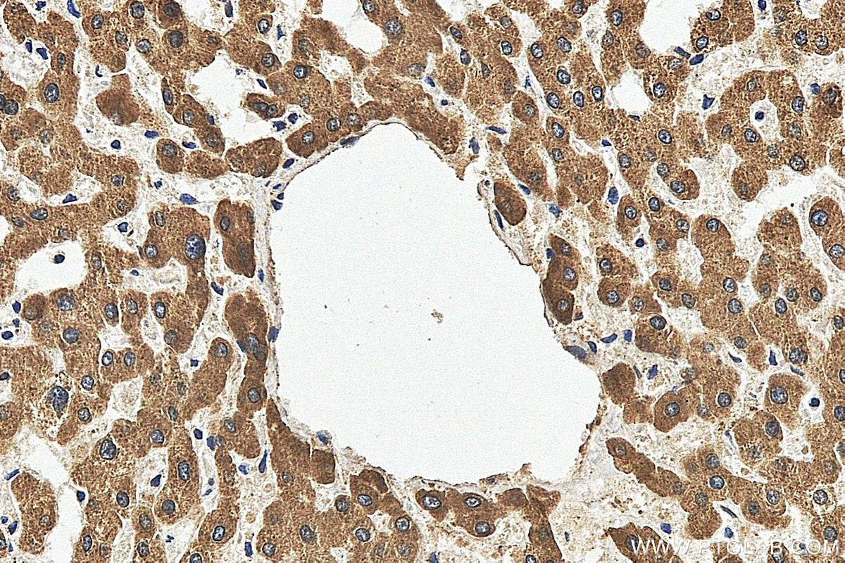 IHC staining of human liver using 25451-1-AP Immunohistochemistry (IHC) staining of human liver tissue using MGST2 Polyclonal antibody (25451-1-AP)