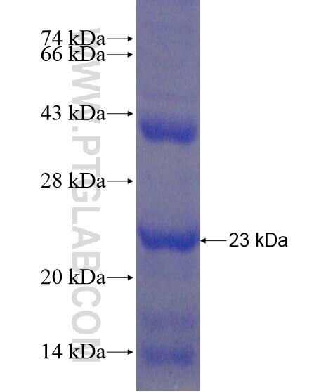 MGST2 fusion protein Ag21105 SDS-PAGE