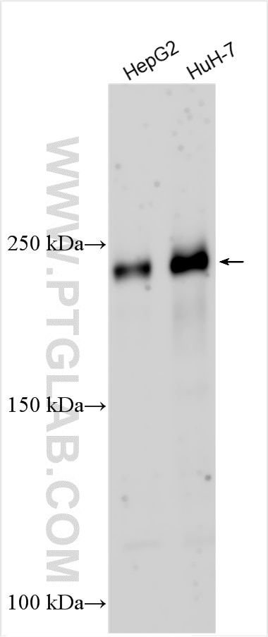Western Blot (WB) analysis of various lysates using CTAGE5 Polyclonal antibody (31986-1-AP)