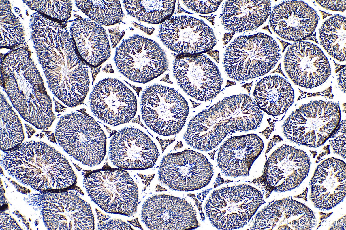 Immunohistochemistry (IHC) staining of mouse testis tissue using MIA3 Polyclonal antibody (17481-1-AP)