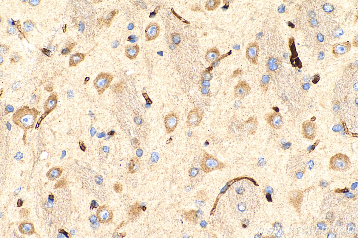 Immunohistochemistry (IHC) staining of mouse brain tissue using MIA3 Polyclonal antibody (17481-1-AP)