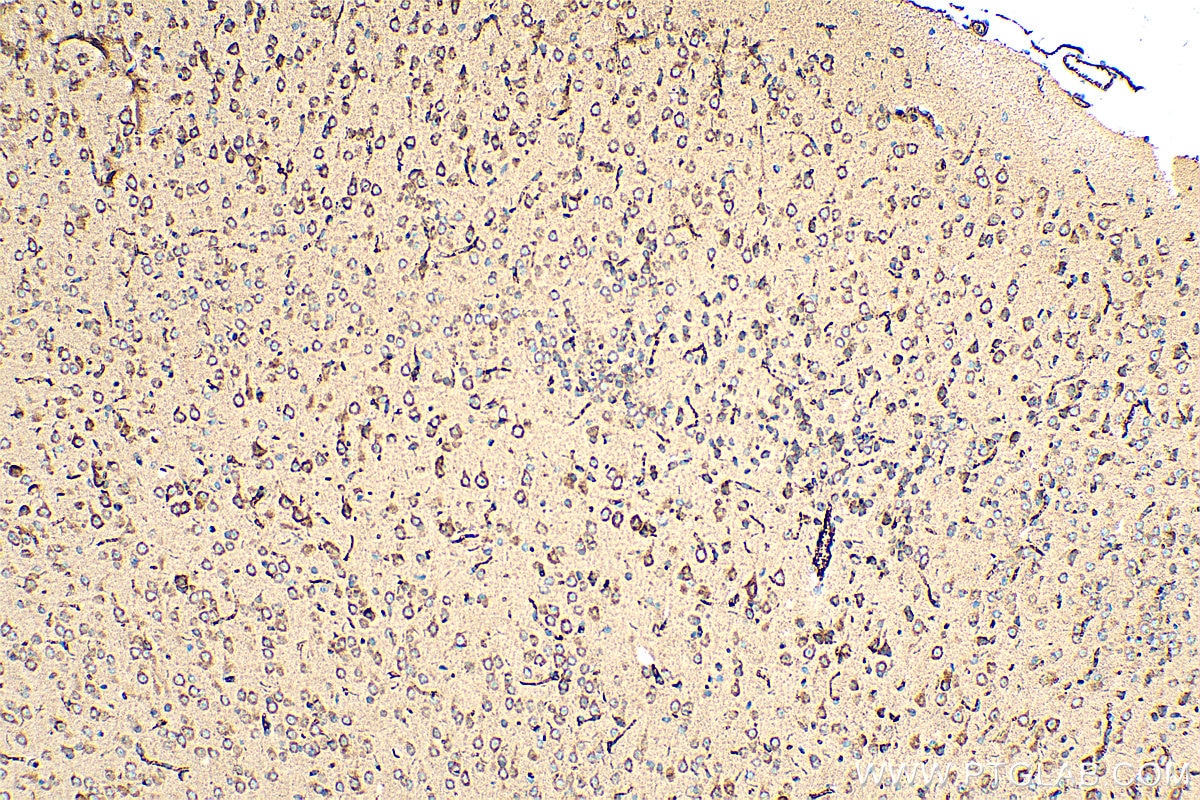 Immunohistochemistry (IHC) staining of mouse brain tissue using MIA3 Polyclonal antibody (17481-1-AP)