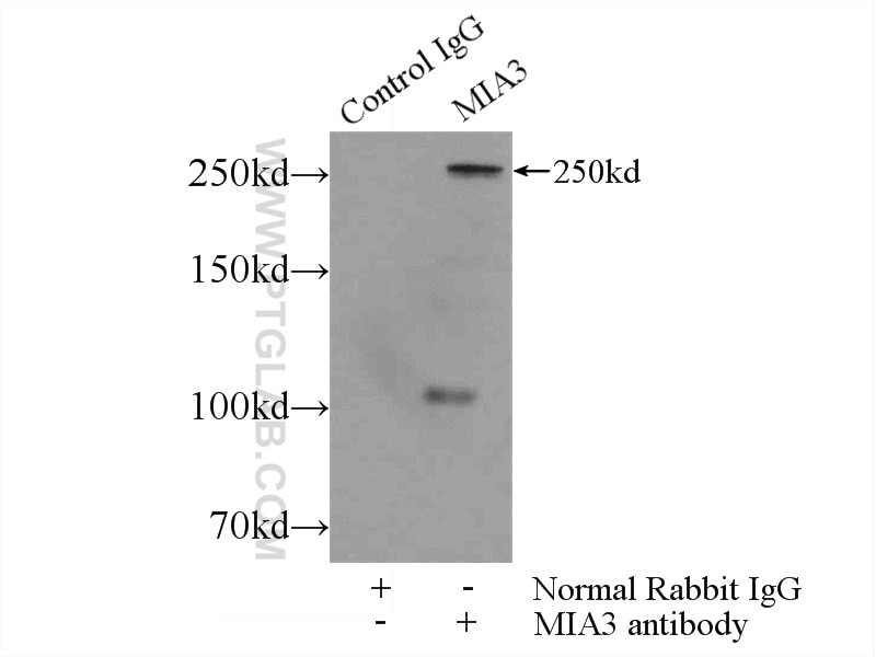 Immunoprecipitation (IP) experiment of HeLa cells using MIA3 Polyclonal antibody (17481-1-AP)