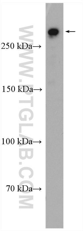 Western Blot (WB) analysis of HEK-293T cells using MIA3 Polyclonal antibody (17481-1-AP)