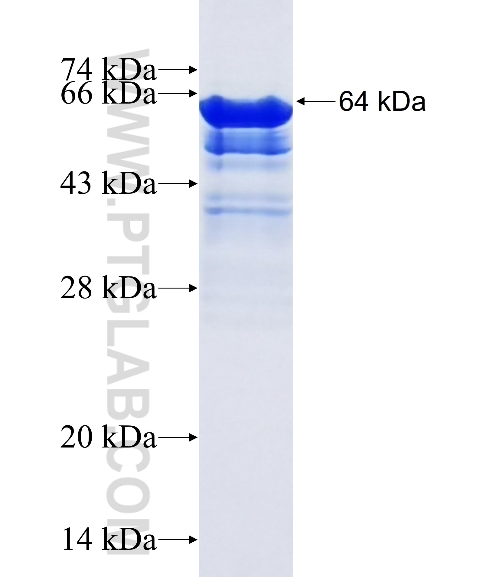 MIA3 fusion protein Ag39740 SDS-PAGE