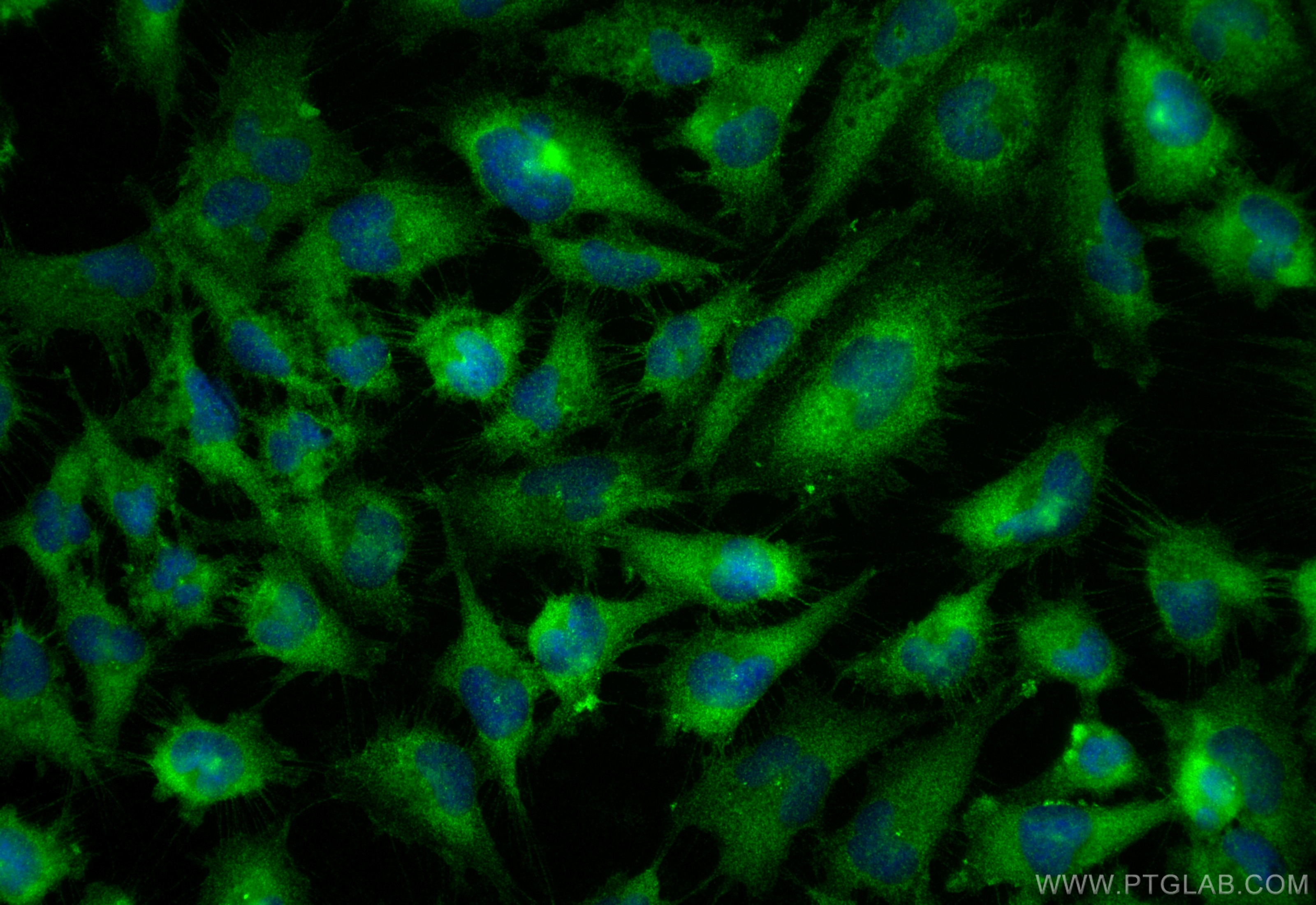 Immunofluorescence (IF) / fluorescent staining of U-251 cells using MIB1 Polyclonal antibody (11893-1-AP)