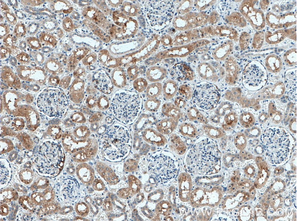 Immunohistochemistry (IHC) staining of human kidney tissue using MIB1 Polyclonal antibody (11893-1-AP)