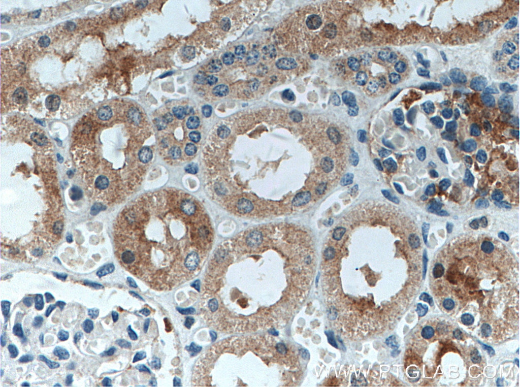 Immunohistochemistry (IHC) staining of human kidney tissue using MIB1 Polyclonal antibody (11893-1-AP)