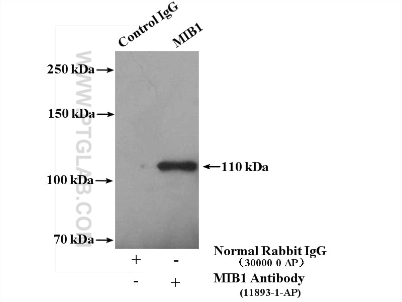 Immunoprecipitation (IP) experiment of K-562 cells using MIB1 Polyclonal antibody (11893-1-AP)