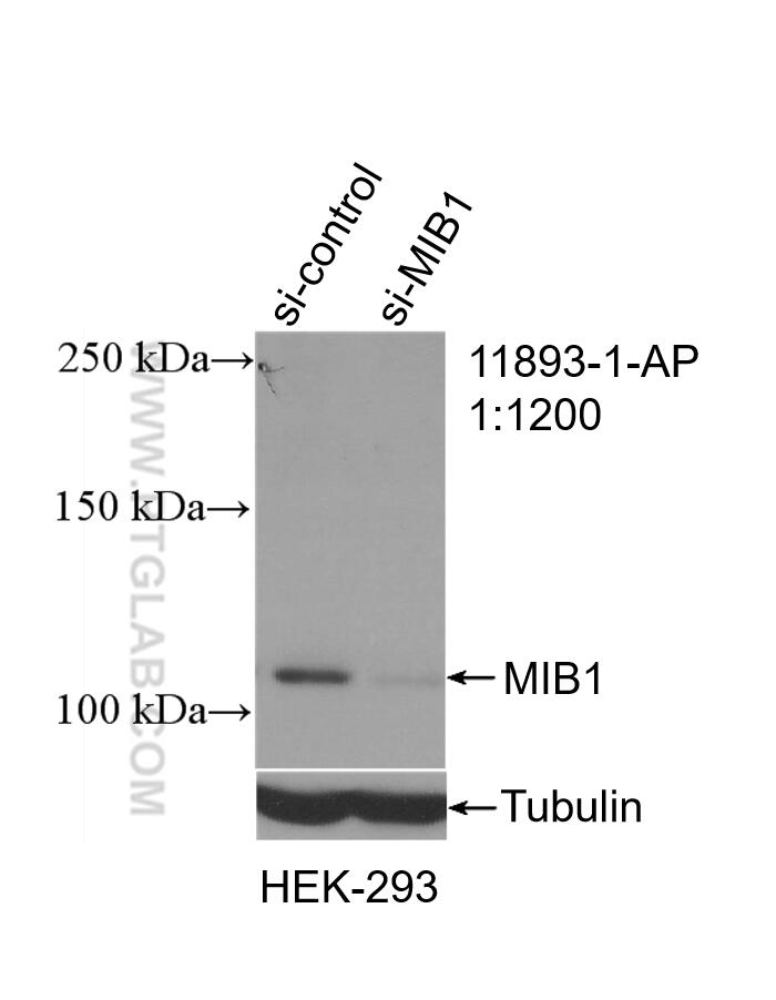 Western Blot (WB) analysis of HEK-293 cells using MIB1 Polyclonal antibody (11893-1-AP)