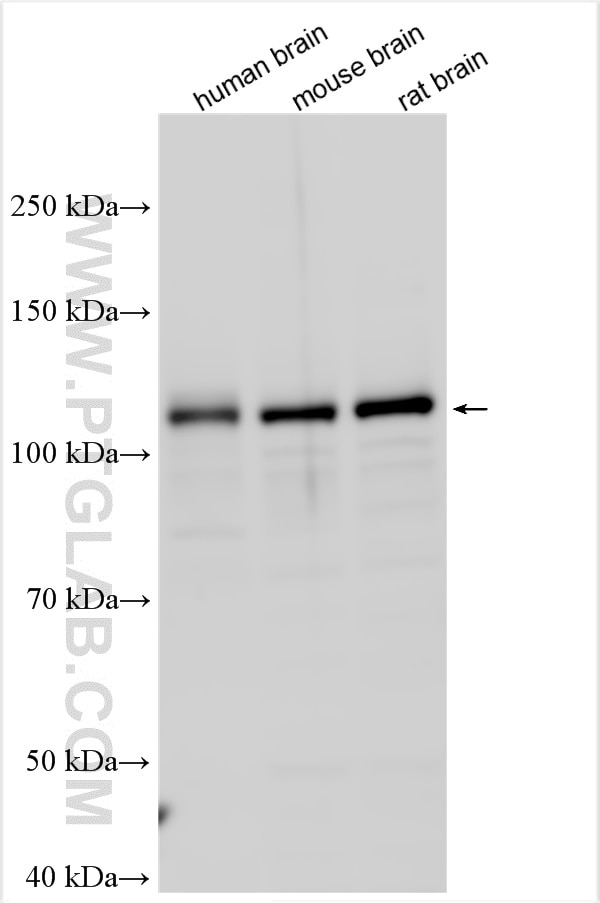 Western Blot (WB) analysis of various lysates using MIB1 Polyclonal antibody (11893-1-AP)