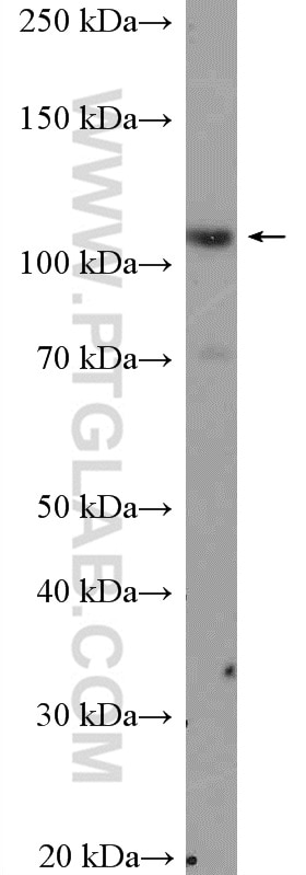 Western Blot (WB) analysis of HEK-293 cells using MIB1 Polyclonal antibody (11893-1-AP)