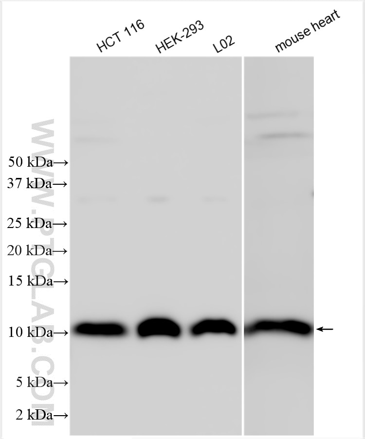 Western Blot (WB) analysis of various lysates using MIC10 Polyclonal antibody (31561-1-AP)