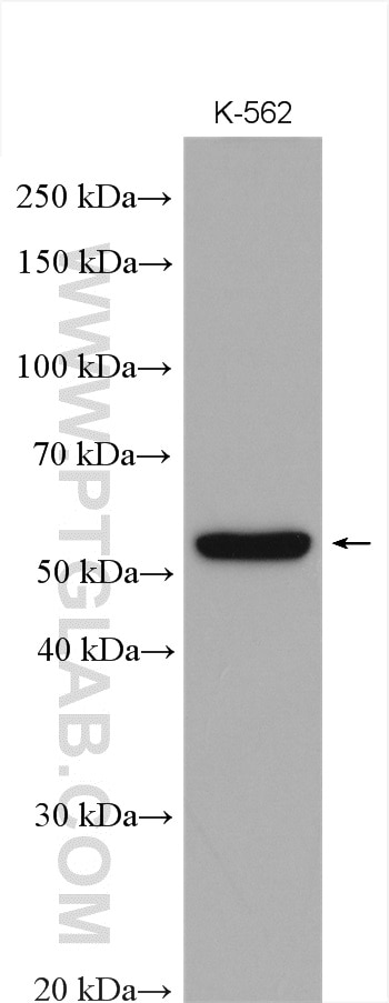 Western Blot (WB) analysis of various lysates using MICA Polyclonal antibody (12619-1-AP)
